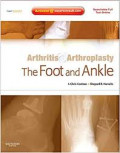 Arthritis & Arthroplasty: The Foot and Ankle