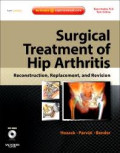 Surgical Treatment of Hip Arthritis: Reconstruction, Replacement, and Revision