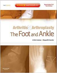 Arthritis & Arthroplasty: The Foot and Ankle